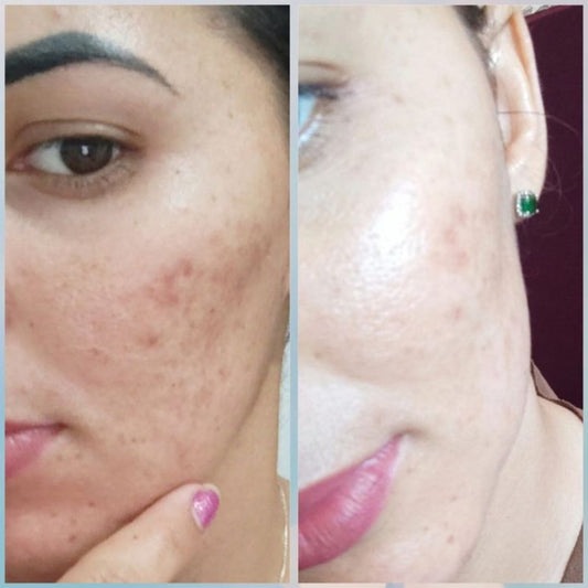 Clear Gel Face Wash PRO with 2% Salicylic + Glycolic Acid